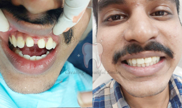  dental clinic in bandra west