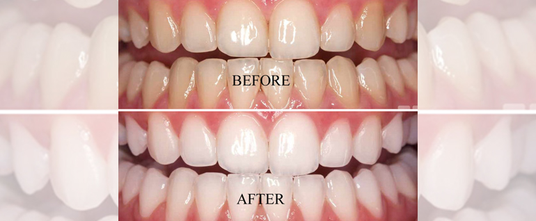 dentist near me